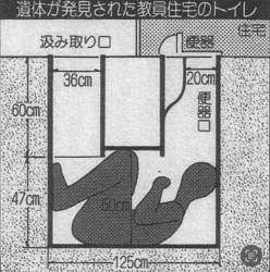 75871 B
